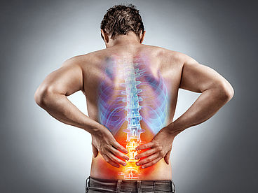 Ankylosierende Spondylitis ist eine chronisch entzündliche rheumatische Erkrankung mit Schmerzen und Versteifung von Gelenken. Sie gehört zur Gruppe der Erkrankungen der Wirbelsäulengelenke und betrifft vorwiegend die Lenden- und Brustwirbelsäule und die Kreuz-Darmbeingelenke. Schmerzen im unteren Rücken sind ein Anzeichen für Morbus Bechterew (Ankylosierende Spondylitis).