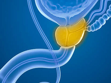 Rözgenaufnahme Prostata und männliches Fortpflanzungsorgan